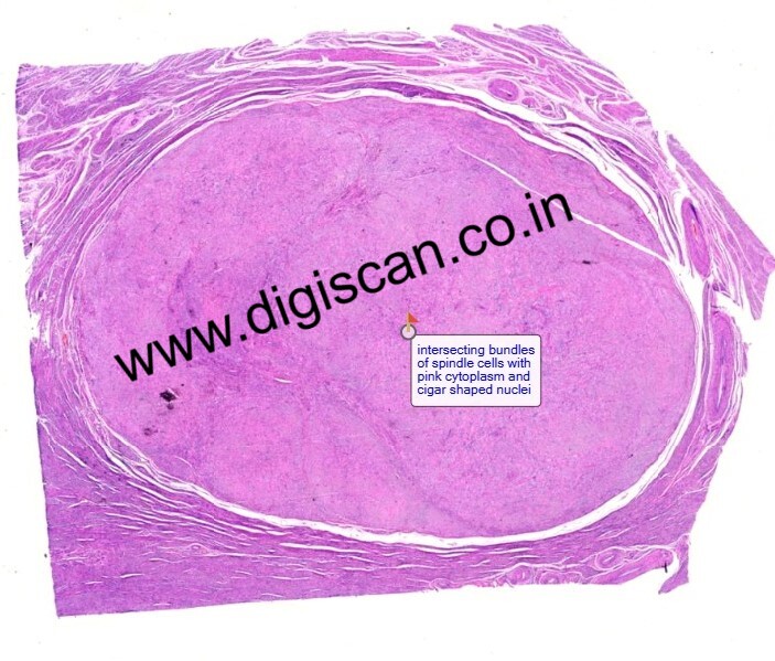 Pathology Digital Slides Set (Basic Pathology & Pathological Processes)